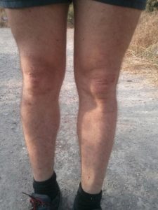 My legs after going out of the stream.... Red and hurt. - Mezar stream