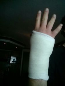 It was a special cast - kind of an expensive plastic cast to hold my broken finger.